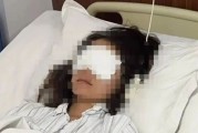 黄山游客在景区遭水枪射伤眼，知情人：水枪购自景区，警方将鉴定
